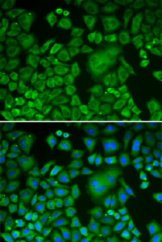 Immunofluorescence analysis of HeLa cells using ACTR3 Polyclonal Antibody