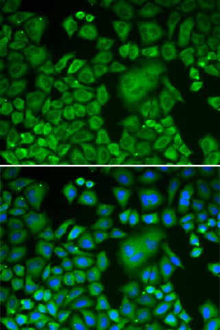 Immunofluorescence analysis of HeLa cells using ACTR3 Polyclonal Antibody