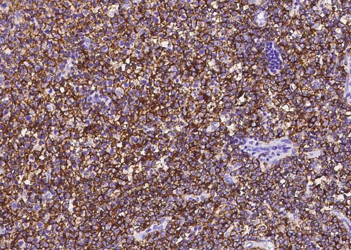 CD20/MS4A1 Monoclonal Antibody - small - 3