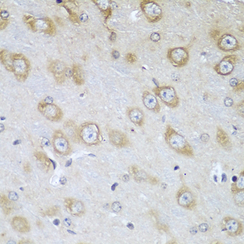 Immunohistochemistry of paraffin-embedded mouse brain using TMOD3 Polyclonal antibody at dilution of 1:100 (40x lens).Perform microwave antigen retrieval with 10 mM PBS buffer pH 7.2 before commencing with IHC staining protocol.