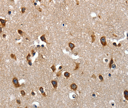 Immunohistochemistry of paraffin-embedded Human brain tissue using LAMA1 Polyclonal Antibody at dilution of 1:70