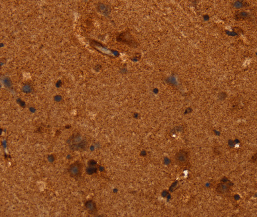 Immunohistochemistry of paraffin-embedded Human brain  tissue using ALG11 Polyclonal Antibody at dilution 1:40