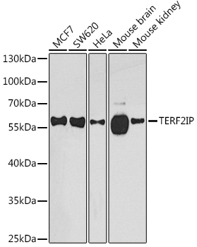 Western blot analysis of extracts of various cell lines using TERF2IP Polyclonal Antibody at 1:1000 dilution.