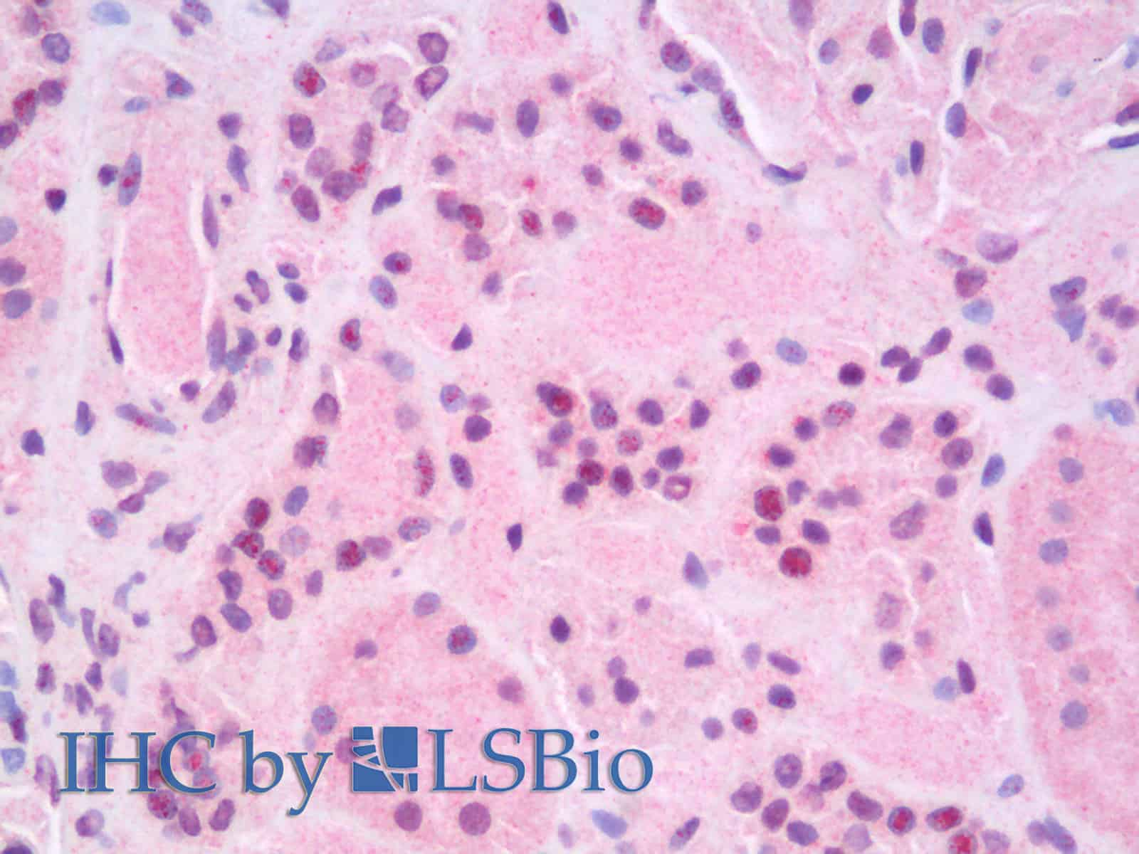 Immunohistochemistry analysis of paraffin-embedded Human Kidney using RELB Polyclonal Antibody(Elabscience Product Detected by Lifespan).