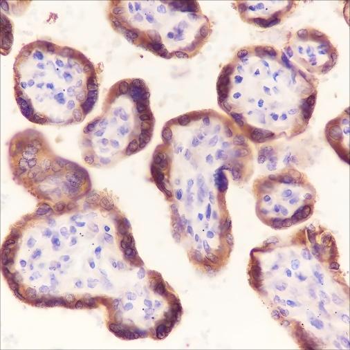 Recombinant Laminin beta 1 Monoclonal Antibody-searchlist-1