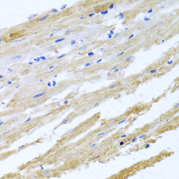 Immunohistochemistry of paraffin-embedded Rat heart using BNIP3 Polyclonal Antibody at dilution of  1:100 (40x lens).