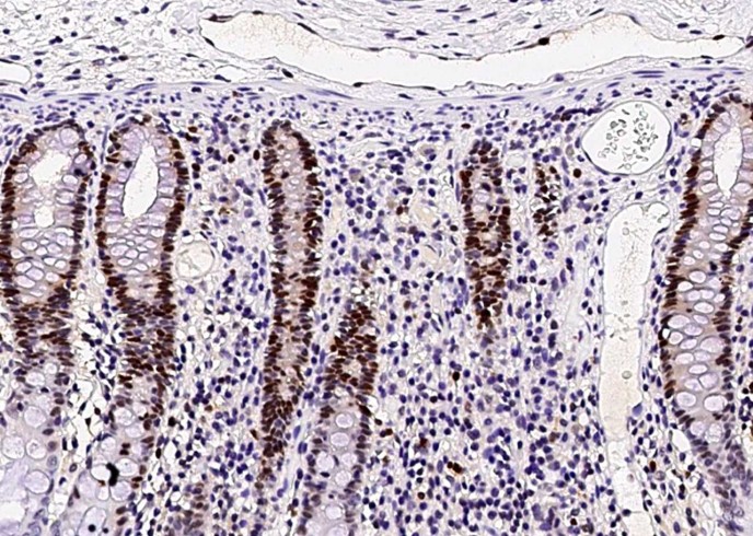 Recombinant ASF1B Monoclonal Antibody - small - 2