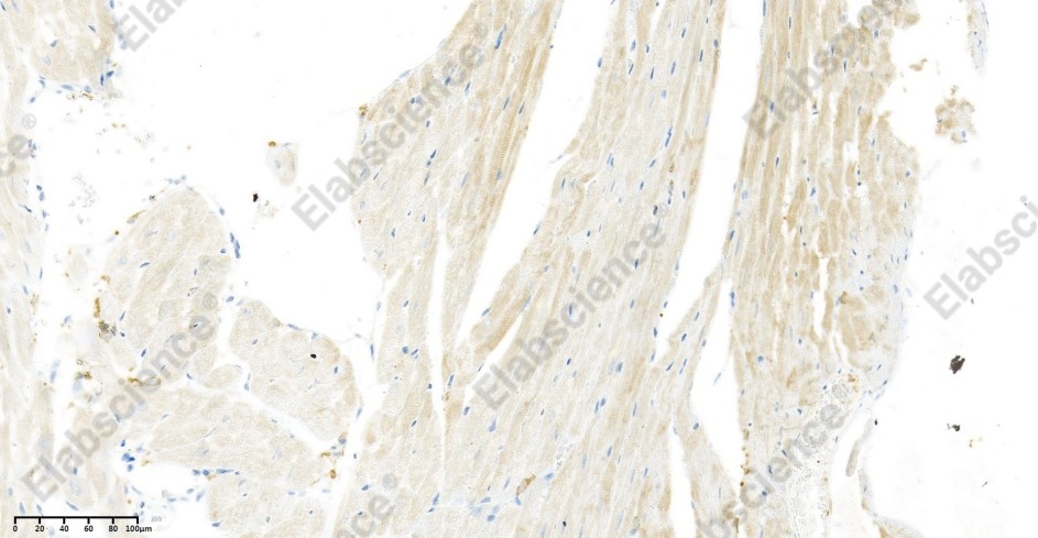 Recombinant VEGFA Monoclonal Antibody - 2