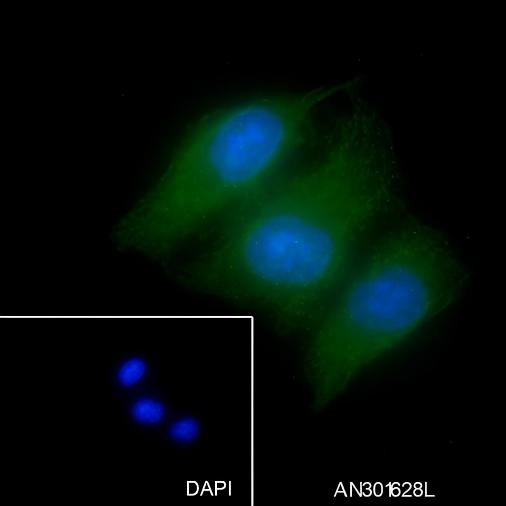 Recombinant Aurora B Monoclonal Antibody - small - 4