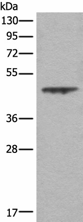 Western blot analysis of A431 cell lysate  using ASS1 Polyclonal Antibody at dilution of 1:350