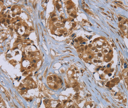 PUS10 Polyclonal Antibody - 2