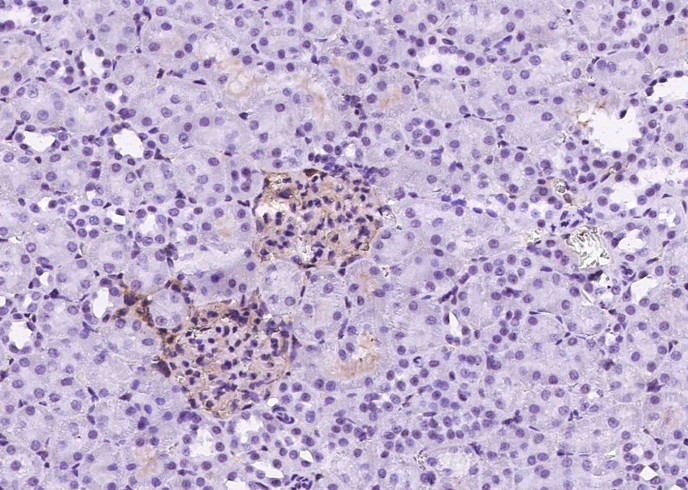 Recombinant ICAM-1/CD54 Monoclonal Antibody-searchlist-1