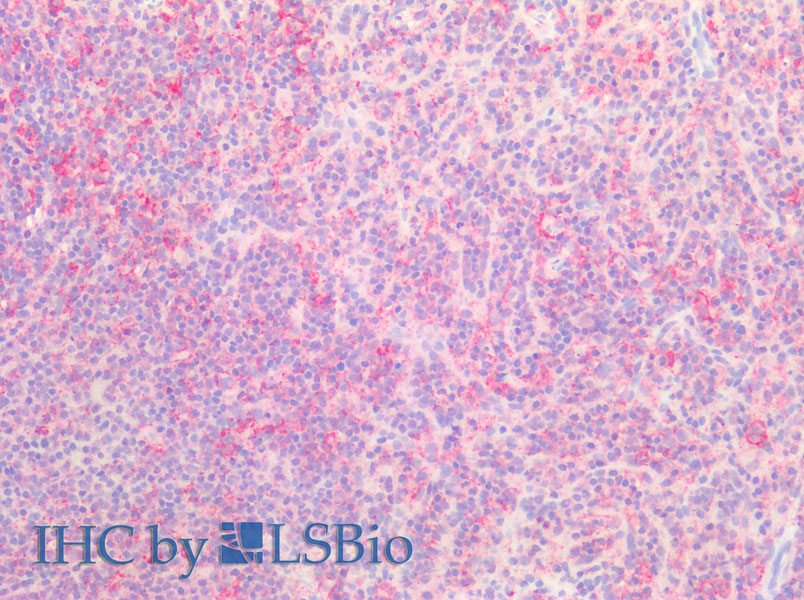 Immunohistochemistry of paraffin-embedded Human spleen using SNAP23 Polyclonal Antibody at dilution of 1:200(Elabscience Product Detected by Lifespan).