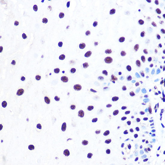 Immunohistochemistry of paraffin-embedded human esophageal using NELFE Polyclonal antibody at dilution of 1:100 (40x lens).Perform high pressure antigen retrieval with 10 mM citrate buffer pH 6.0 before commencing with IHC staining protocol.