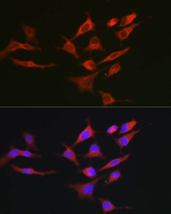 Immunofluorescence analysis of HeLa cells using Bcl-2 Polyclonal Antibody at dilution of 1:200. Blue: DAPI for nuclear staining.