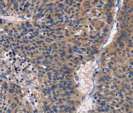 PKC delta Polyclonal Antibody - 2