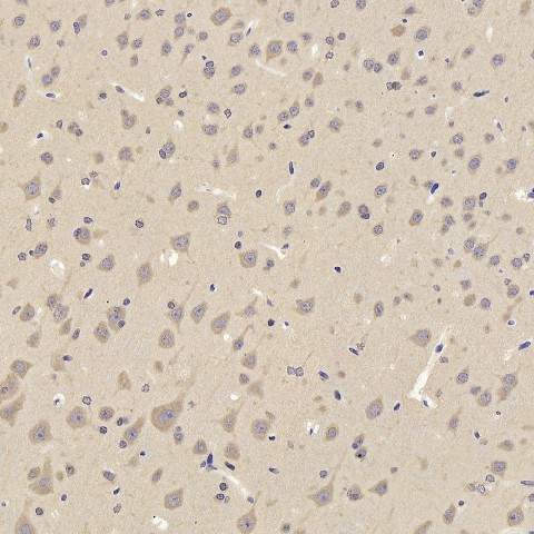 Immunohistochemistry analysis of paraffin-embedded rat cortex  using TAC1 Polyclonal Antibody at dilution of 1:300.