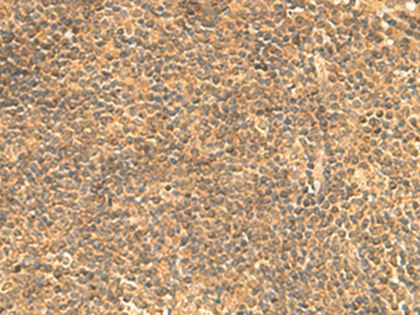 Immunohistochemistry of paraffin-embedded Human tonsil tissue  using FAM186B Polyclonal Antibody at dilution of 1:25(?200)