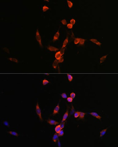 Immunofluorescence analysis of NIH/3T3 cells using PIK3CA Polyclonal Antibody at dilution of  1:100. Blue: DAPI for nuclear staining.