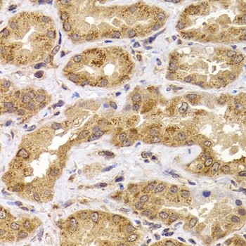 Immunohistochemistry of paraffin-embedded Human kidney using ANAPC5 Polyclonal Antibody at dilution of 1:100 (40x lens).