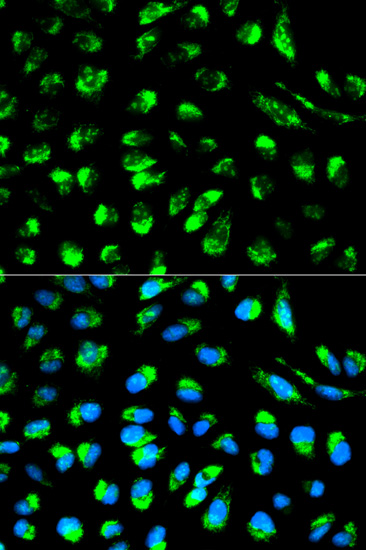 Immunofluorescence analysis of HeLa cells using ECI1 Polyclonal Antibody