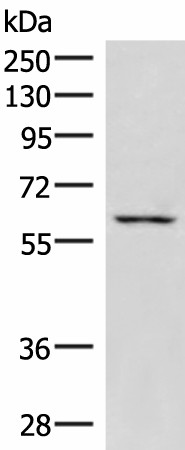 Western blot analysis of K562 cell lysate  using JRKL Polyclonal Antibody at dilution of 1:1000