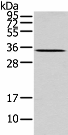 Western Blot analysis of Mouse liver tissue using UCP2 Polyclonal Antibody at dilution of 1/200