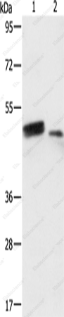 RARB Polyclonal Antibody - 1