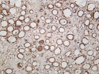 Recombinant ATF-5 Monoclonal Antibody - 1