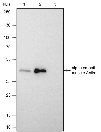 Recombinant alpha smooth muscle Actin Monoclonal Antibody - small - 10