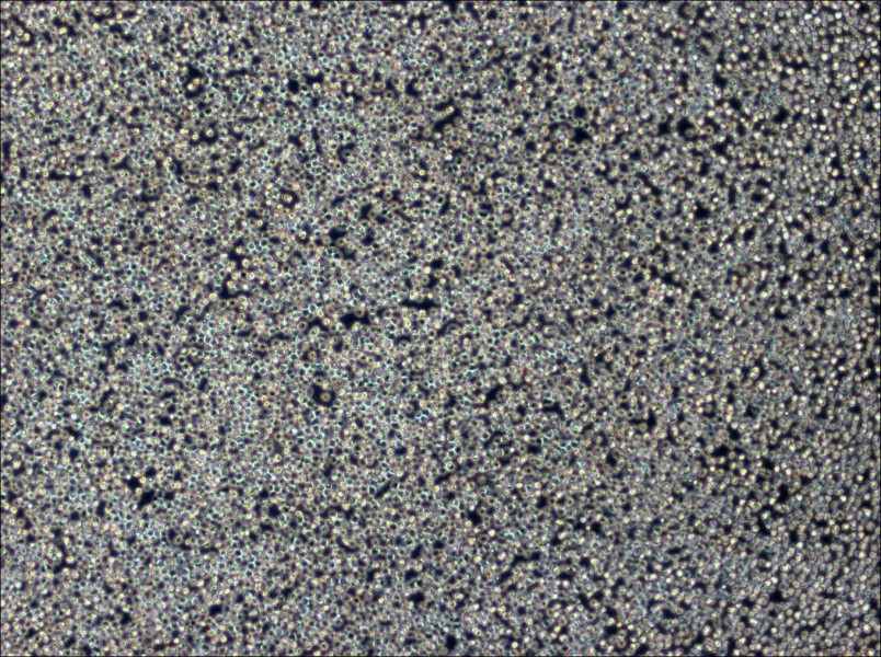 Z-138 Cell Complete MediumZ-138 Cell Complete Medium - 2