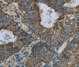 NDUFA5 Polyclonal Antibody - 3