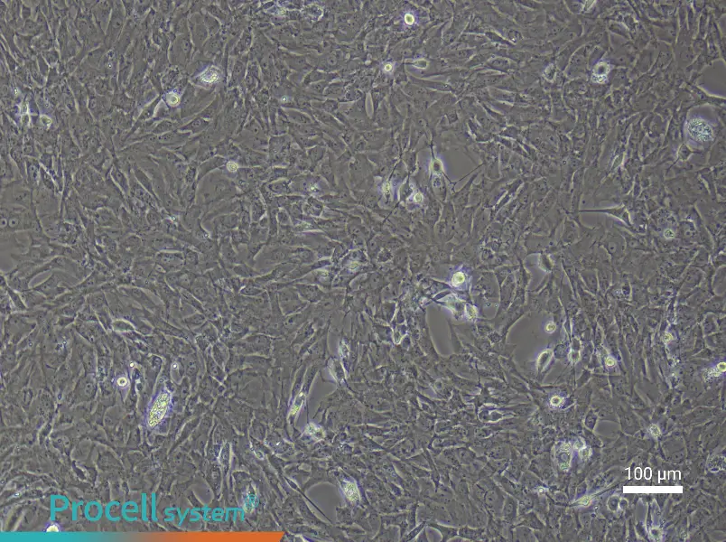 Rat Skeletal Muscle Fibroblast Complete Medium - 3
