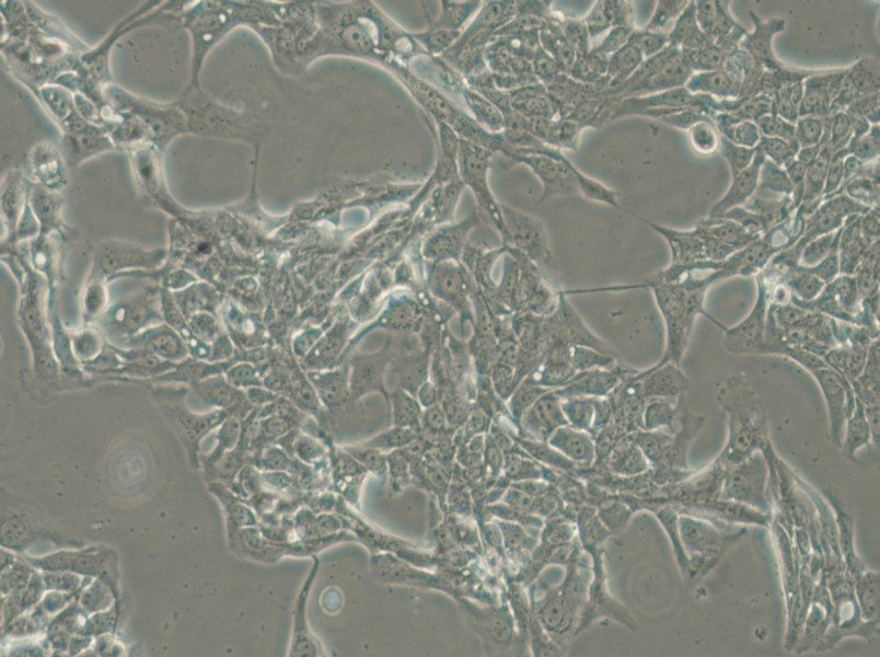 HCC70 Cell Complete Medium - 4