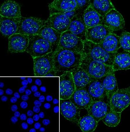 Recombinant Non-Phospho (Active) β-Catenin (Ser33, Ser37, Thr41) Monoclonal Antibody - small - 5