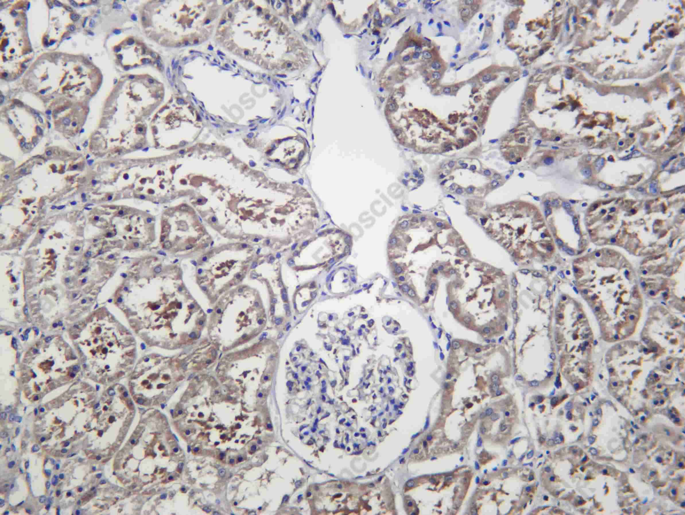 Recombinant Noxa Monoclonal Antibody - 2