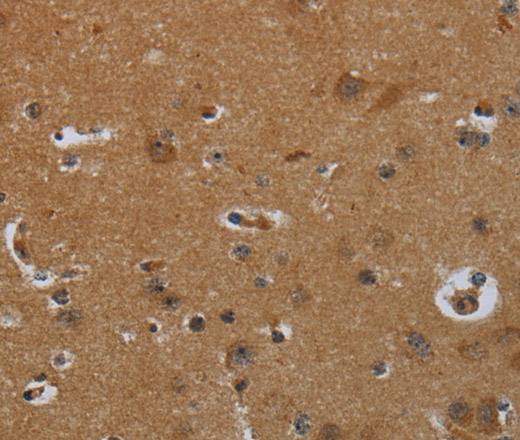 Immunohistochemistry of paraffin-embedded Human brain  tissue using ENTPD7 Polyclonal Antibody at dilution 1:60