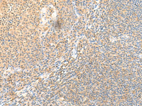 Immunohistochemistry of paraffin-embedded Human tonsil tissue  using SSC4D Polyclonal Antibody at dilution of 1:70(?200)