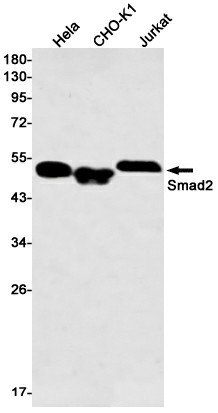 Western blot detection of Smad2 in Hela,CHO-K1,Jurkat cell lysates using Smad2 Rabbit mAb(1:500 diluted).Predicted band size:52kDa.Observed band size:52kDa.