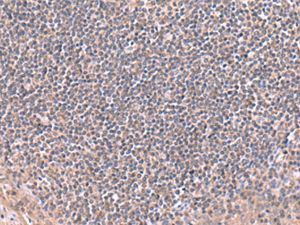 Immunohistochemistry of paraffin-embedded Human tonsil tissue  using RIC8A Polyclonal Antibody at dilution of 1:80(?200)