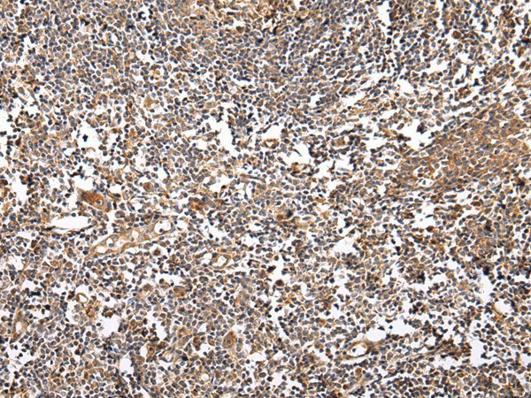 Immunohistochemistry of paraffin-embedded Human tonsil using VSIG8 Polyclonal Antibody at dilution of  1/30