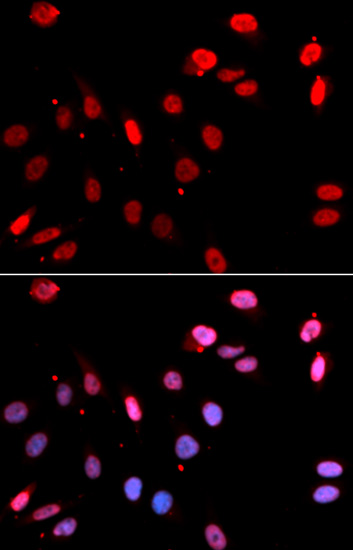 Immunofluorescence analysis of U2OS cells using RAD18 Polyclonal Antibody