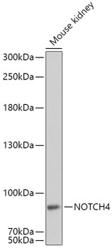 Western blot analysis of extracts of Mouse kidney using NOTCH4 Polyclonal Antibody at dilution of 1:1000.