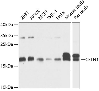 Western blot analysis of extracts of various cell lines using CETN1 Polyclonal Antibody at 1:1000 dilution.