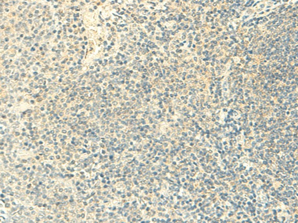 Immunohistochemistry of paraffin-embedded Human tonsil tissue  using FMNL2 Polyclonal Antibody at dilution of 1:50(?200)