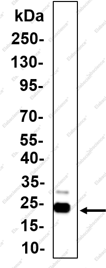 Recombinant AID Monoclonal Antibody - 2
