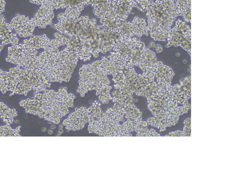 NCI-H187 Cell Complete MediumNCI-H187 Cell Complete Medium - 2