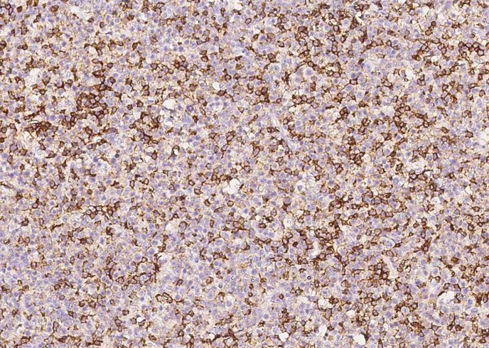 CD45/PTPRC Monoclonal Antibody-searchlist-1