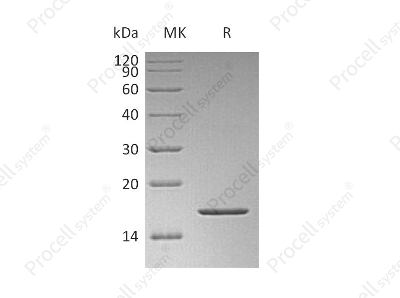 FGF-2/bFGF/FGF-b (K128N), Human, Recombinant