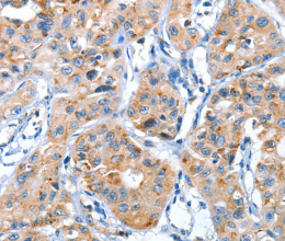 AUP1 Polyclonal Antibody - 3